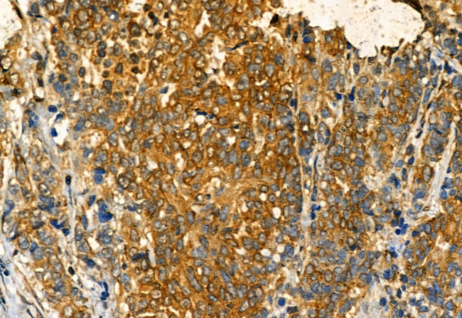 Phospho-IRE1 alpha (Ser724) Antibody in Immunohistochemistry (Paraffin) (IHC (P))