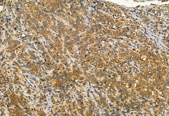 Phospho-IRE1 alpha (Ser724) Antibody in Immunohistochemistry (Paraffin) (IHC (P))