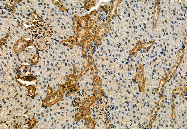 Phospho-IRE1 alpha (Ser724) Antibody in Immunohistochemistry (Paraffin) (IHC (P))