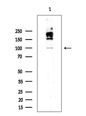 Phospho-IRE1 alpha (Ser724) Antibody in Western Blot (WB)