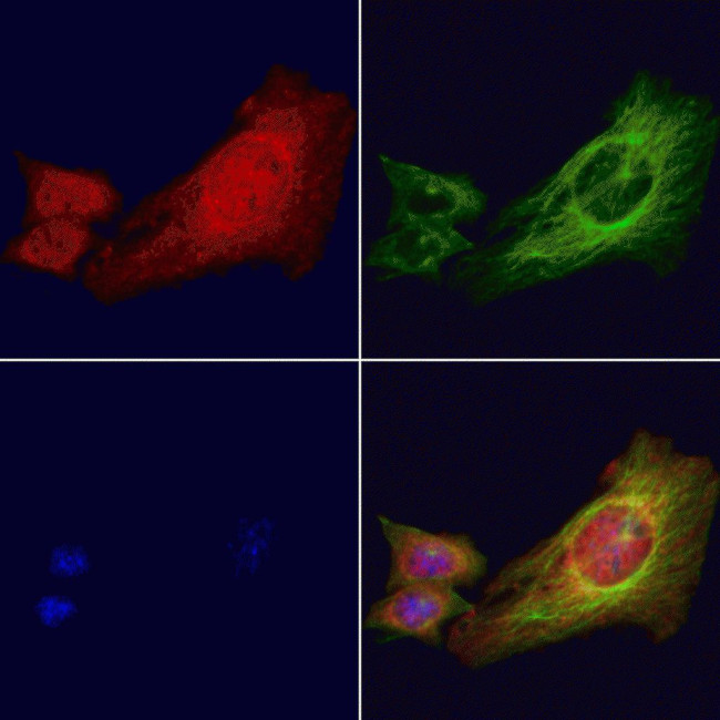 Phospho-IRE1 alpha (Ser724) Antibody in Immunocytochemistry (ICC/IF)