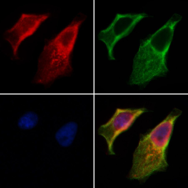 Phospho-IRE1 alpha (Ser724) Antibody in Immunocytochemistry (ICC/IF)