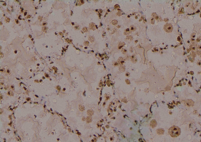 Phospho-IRE1 alpha (Ser724) Antibody in Immunohistochemistry (Paraffin) (IHC (P))