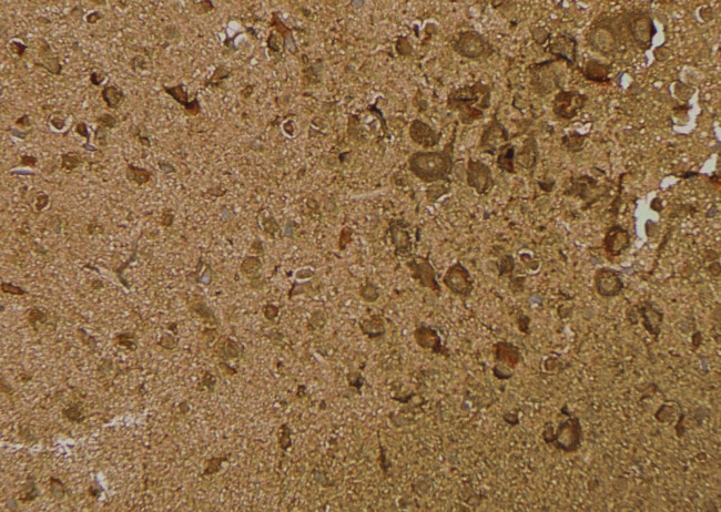 Phospho-IRE1 alpha (Ser724) Antibody in Immunohistochemistry (Paraffin) (IHC (P))