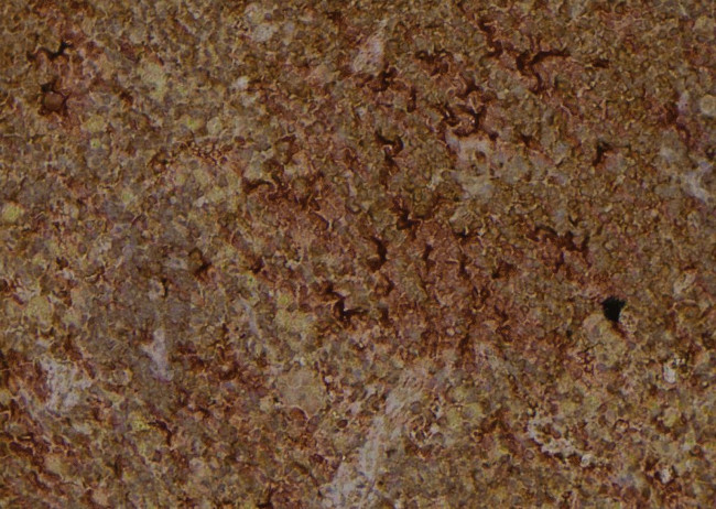 Phospho-IRE1 alpha (Ser724) Antibody in Immunohistochemistry (Paraffin) (IHC (P))