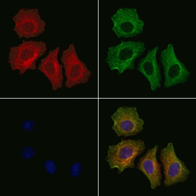 Phospho-IRE1 alpha (Tyr628) Antibody in Immunocytochemistry (ICC/IF)