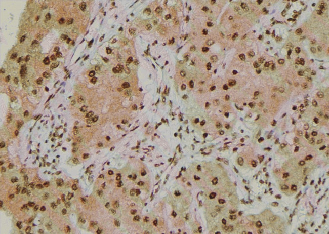 Phospho-IRE1 alpha (Tyr628) Antibody in Immunohistochemistry (Paraffin) (IHC (P))