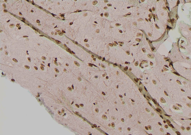 Phospho-IRE1 alpha (Tyr628) Antibody in Immunohistochemistry (Paraffin) (IHC (P))