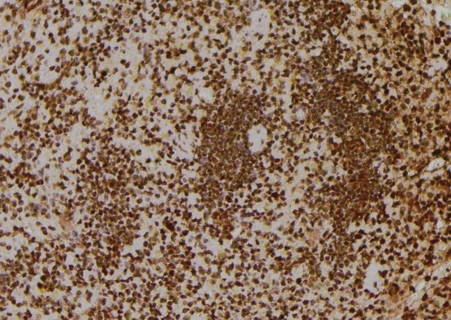 Phospho-IRE1 alpha (Tyr628) Antibody in Immunohistochemistry (Paraffin) (IHC (P))