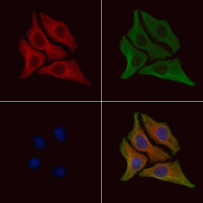 Phospho-DR6 (Thr460) Antibody in Immunocytochemistry (ICC/IF)