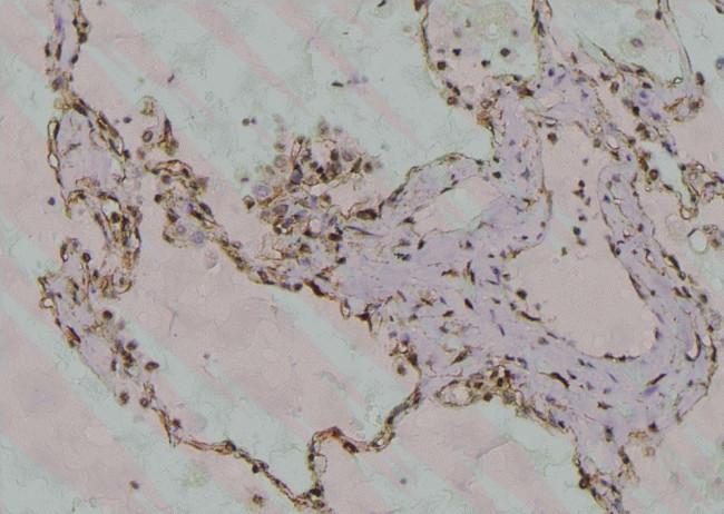 Phospho-DR6 (Thr460) Antibody in Immunohistochemistry (Paraffin) (IHC (P))