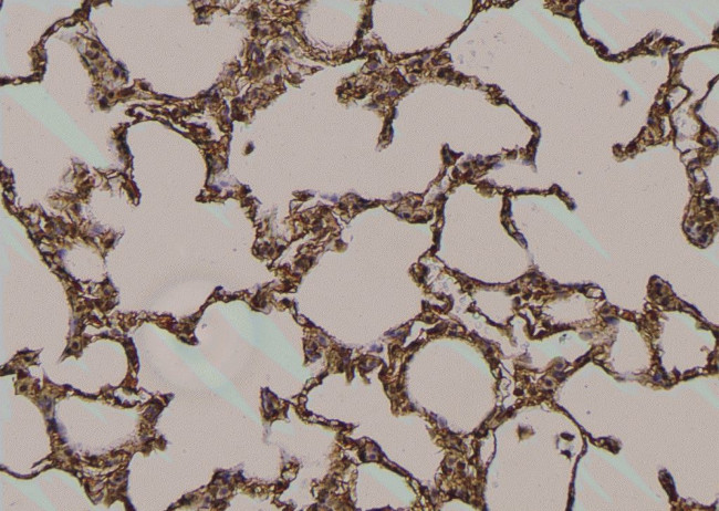 Phospho-DR6 (Thr460) Antibody in Immunohistochemistry (Paraffin) (IHC (P))