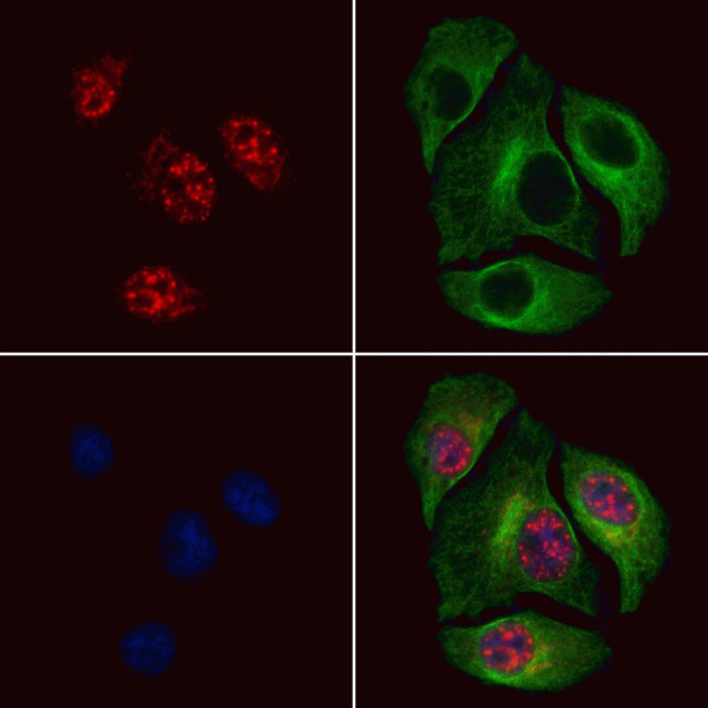 Phospho-MSK2 (Thr687) Antibody in Immunocytochemistry (ICC/IF)