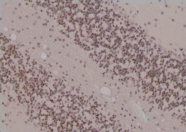 Phospho-RAD17 (Ser86) Antibody in Immunohistochemistry (Paraffin) (IHC (P))