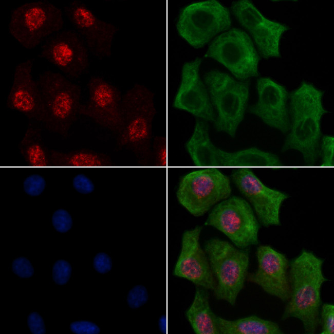 Phospho-RAD17 (Ser86) Antibody in Immunocytochemistry (ICC/IF)