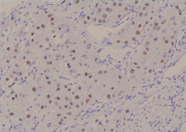 Phospho-NFAT5 (Ser145) Antibody in Immunohistochemistry (Paraffin) (IHC (P))