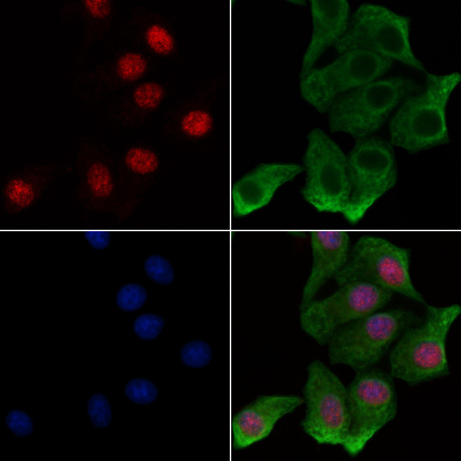 Phospho-NFAT5 (Ser134) Antibody in Immunocytochemistry (ICC/IF)