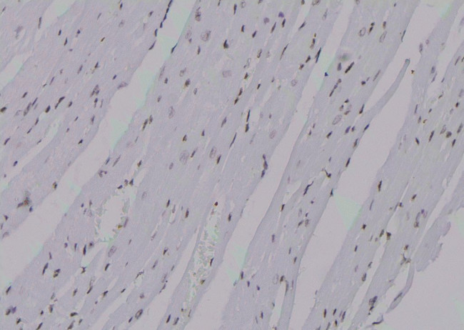 Phospho-KIF20A (Tyr869) Antibody in Immunohistochemistry (Paraffin) (IHC (P))