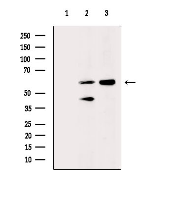 Phospho-OXSR1 (Ser339) Antibody in Western Blot (WB)