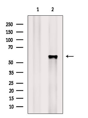 Phospho-OXSR1 (Ser339) Antibody in Western Blot (WB)