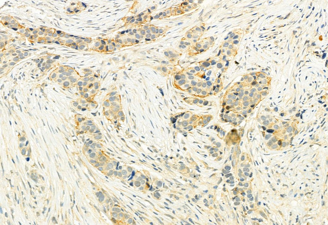 Phospho-LATS1 (Thr1079) Antibody in Immunohistochemistry (Paraffin) (IHC (P))