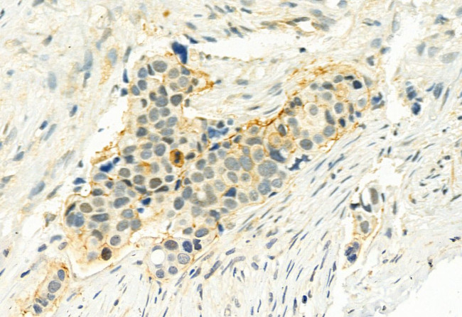 Phospho-LATS1 (Thr1079) Antibody in Immunohistochemistry (Paraffin) (IHC (P))