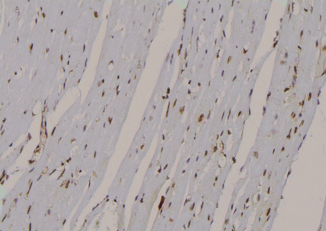 Phospho-LATS1 (Thr1079) Antibody in Immunohistochemistry (Paraffin) (IHC (P))