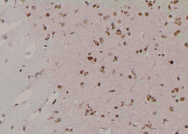 Phospho-LATS1 (Tyr283) Antibody in Immunohistochemistry (Paraffin) (IHC (P))