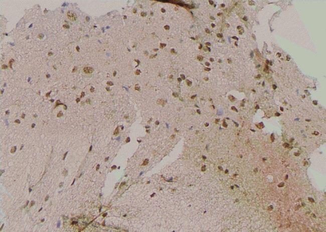 Phospho-LATS1 (Tyr283) Antibody in Immunohistochemistry (Paraffin) (IHC (P))