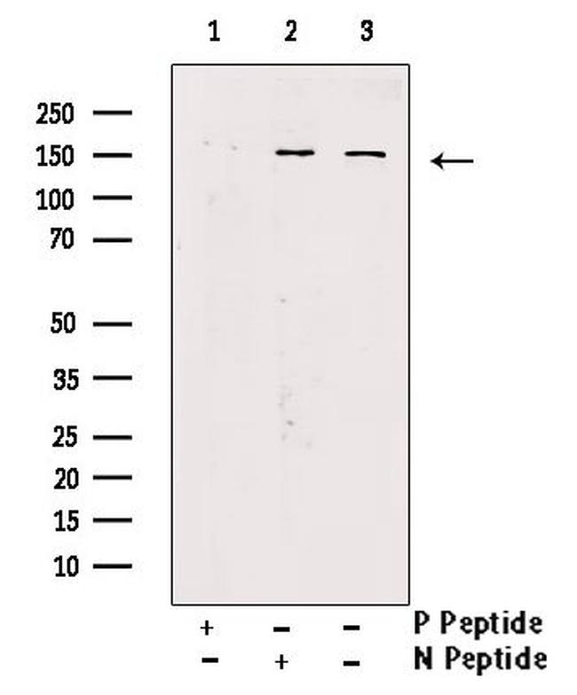 Phospho-LATS1 (Tyr283) Antibody in Western Blot (WB)