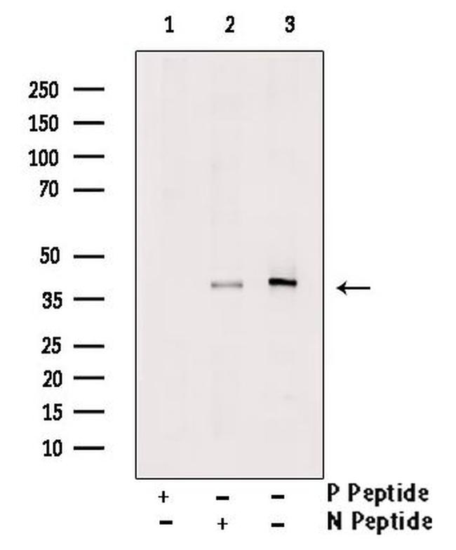 Phospho-LDHA (Tyr10) Antibody in Western Blot (WB)
