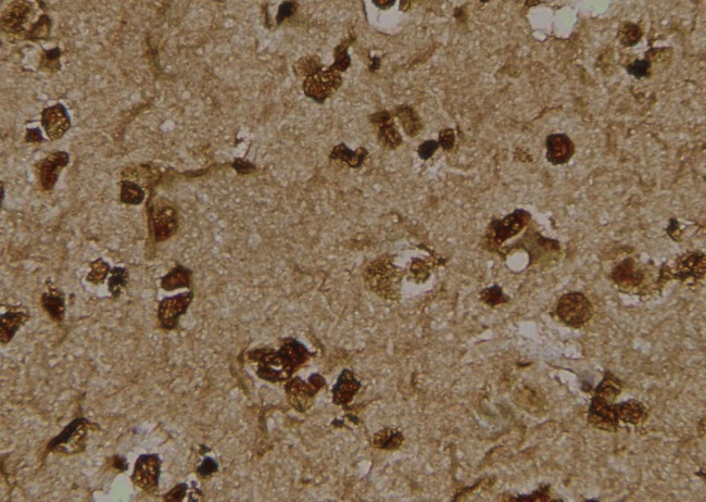 Phospho-LDHA (Tyr239) Antibody in Immunohistochemistry (Paraffin) (IHC (P))