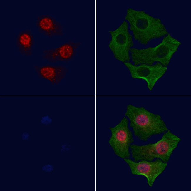 Phospho-c-Myc (Ser293) Antibody in Immunocytochemistry (ICC/IF)