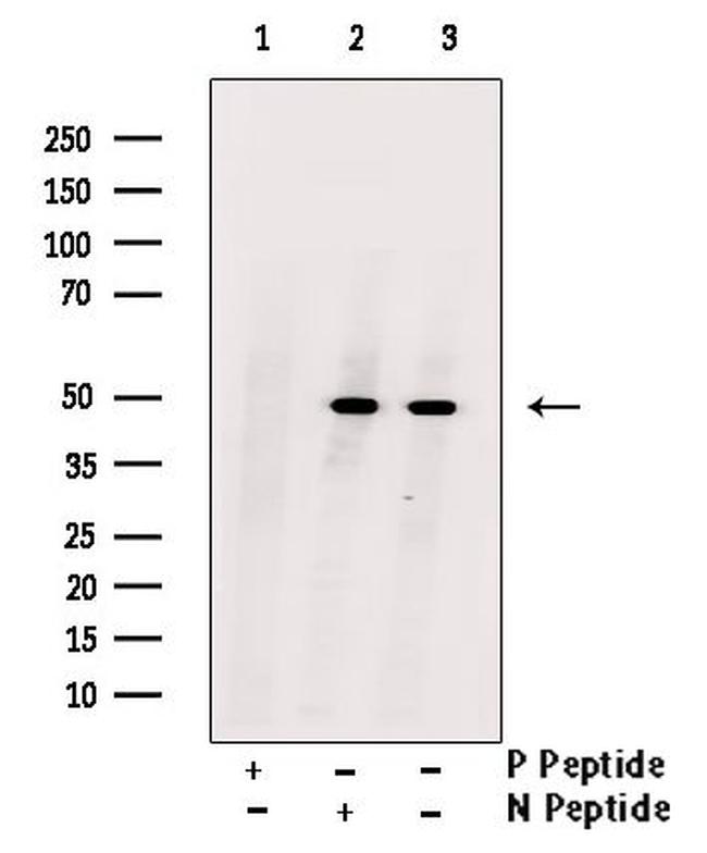 Phospho-c-Myc (Ser293) Antibody in Western Blot (WB)