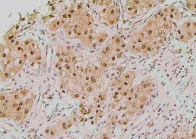 Phospho-TK1 (Tyr181) Antibody in Immunohistochemistry (Paraffin) (IHC (P))