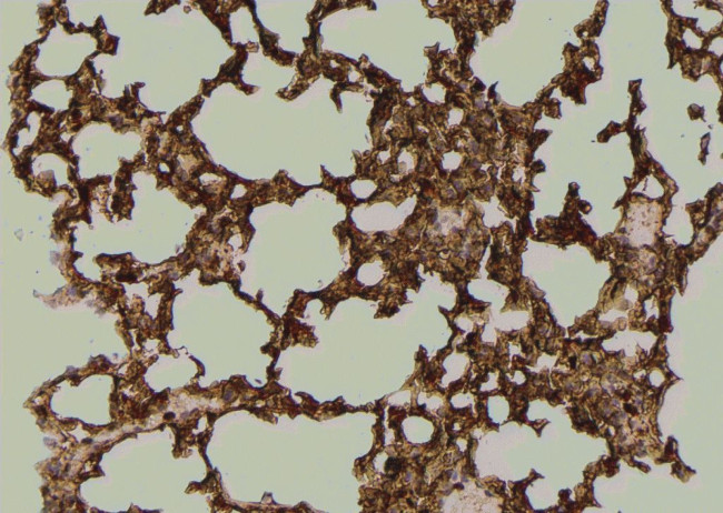 Phospho-TK1 (Tyr181) Antibody in Immunohistochemistry (Paraffin) (IHC (P))