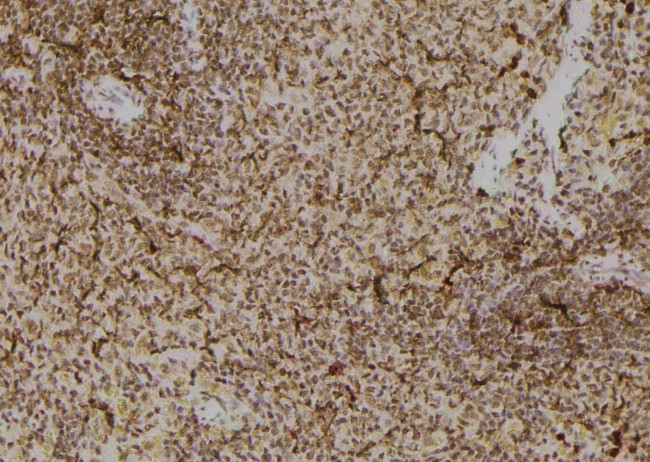 Phospho-TK1 (Tyr181) Antibody in Immunohistochemistry (Paraffin) (IHC (P))