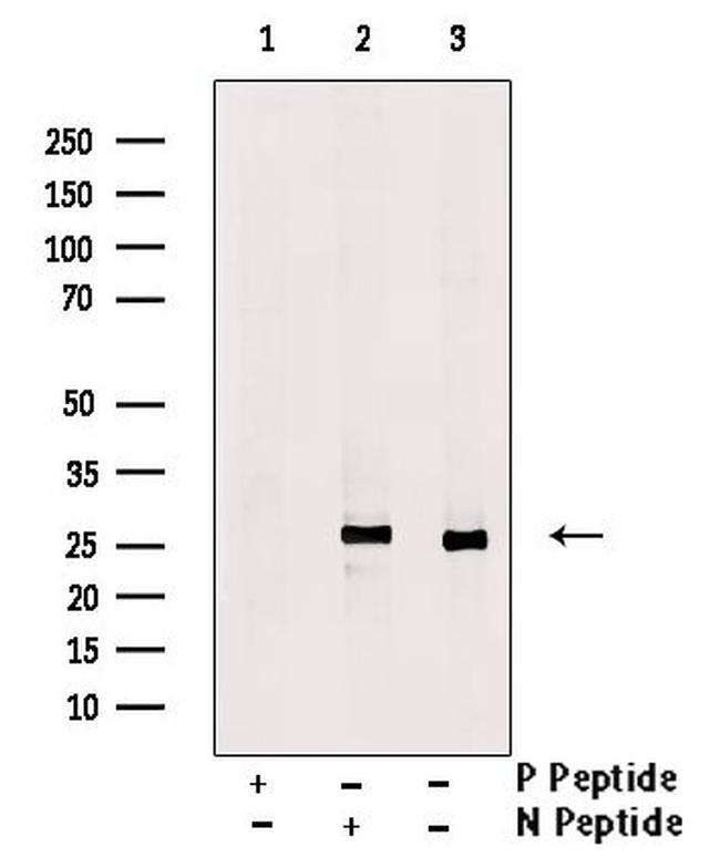 Phospho-TK1 (Tyr181) Antibody in Western Blot (WB)