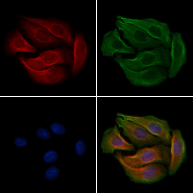 Phospho-TrkA (Tyr496) Antibody in Immunocytochemistry (ICC/IF)