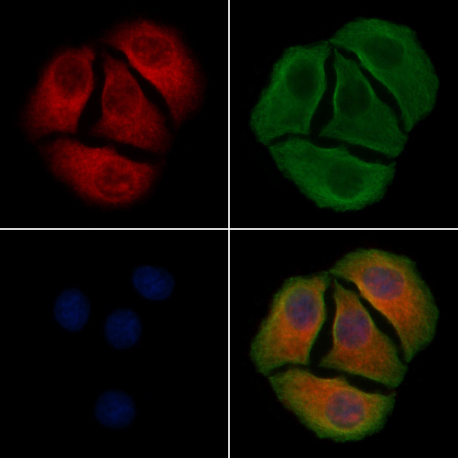 Phospho-TrkA (Tyr791) Antibody in Immunocytochemistry (ICC/IF)