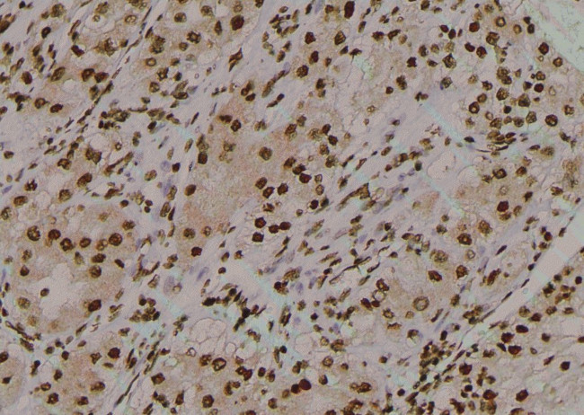 Phospho-EIF2S1 (Tyr150) Antibody in Immunohistochemistry (Paraffin) (IHC (P))