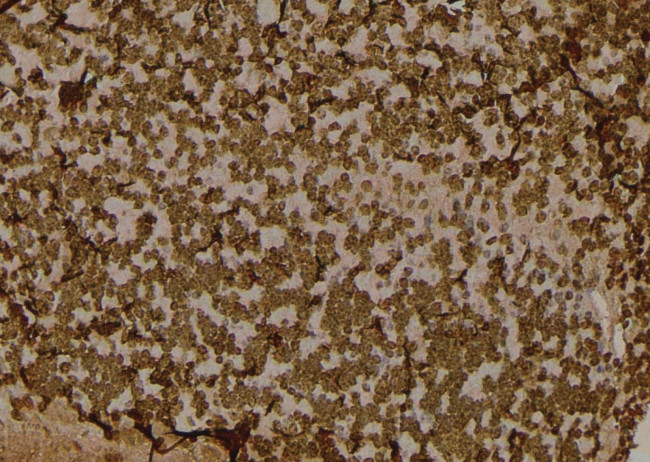 Phospho-EIF2S1 (Tyr150) Antibody in Immunohistochemistry (Paraffin) (IHC (P))