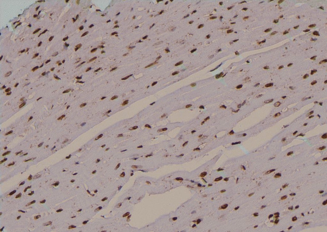 Phospho-EIF2S1 (Tyr150) Antibody in Immunohistochemistry (Paraffin) (IHC (P))