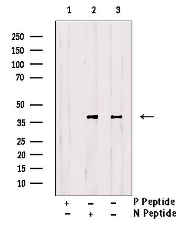 Phospho-EIF2S1 (Tyr150) Antibody in Western Blot (WB)