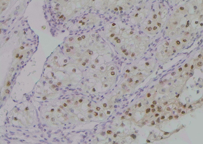 Phospho-PKC beta-1 (Thr642, Thr644) Antibody in Immunohistochemistry (Paraffin) (IHC (P))