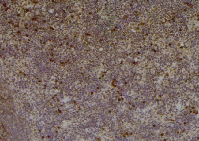 Phospho-PKC beta-1 (Thr642, Thr644) Antibody in Immunohistochemistry (Paraffin) (IHC (P))