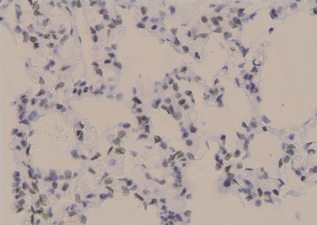 Phospho-PKC beta-1 (Thr642, Thr644) Antibody in Immunohistochemistry (Paraffin) (IHC (P))