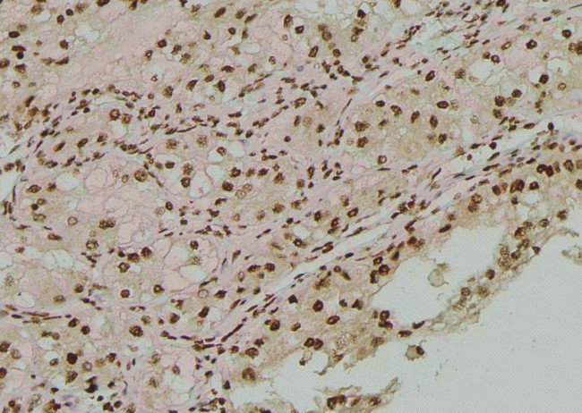 Phospho-Fyn (Tyr213, Tyr214) Antibody in Immunohistochemistry (Paraffin) (IHC (P))