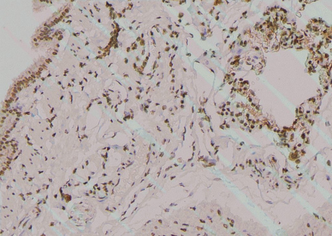 Phospho-Fyn (Tyr213, Tyr214) Antibody in Immunohistochemistry (Paraffin) (IHC (P))