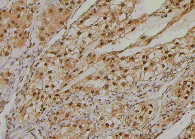 Phospho-NPM1 (Ser10) Antibody in Immunohistochemistry (Paraffin) (IHC (P))